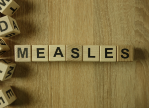 Read more about the article HEALTH ALERT: Measles case confirmed in Santa Clara County with public exposures
